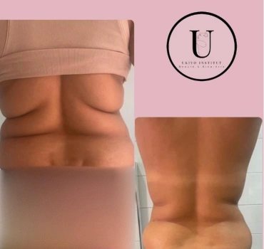 Ukiyo 